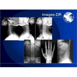 DR. Draagbaar Digitaal Radiografiesysteem, Mammogrpahy-RÖNTGENSTRAALsysteem