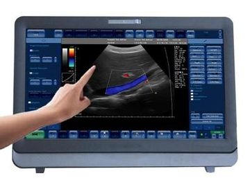 Good price Medisch 3D/4D-de Ultrasone klanksysteem van Kleurendoppler Draagbaar met 15 duim HOOFDmonitor online