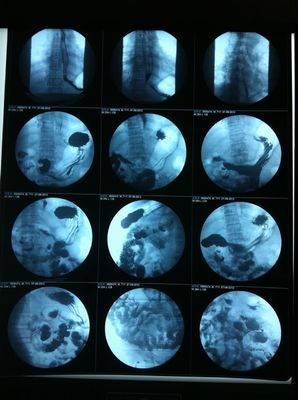 Good price Doorzichtig Inkjet X Ray Film Glossy Surface Silk-het Schermdruk online
