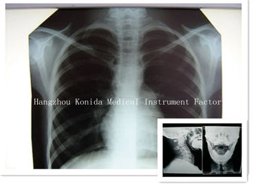 Good price Digitale Medische Röntgenstraal Droge Film 14 van de de Gezondheidsweergave van x 17inch de Radiografische Film online