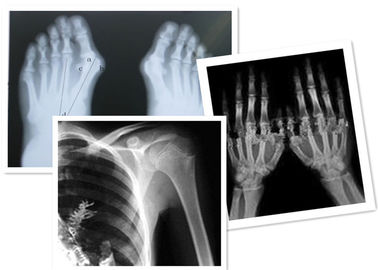 Thermische Digitale Röntgenstraalfilm Fuji Medisch voor Radiografieonderzoek