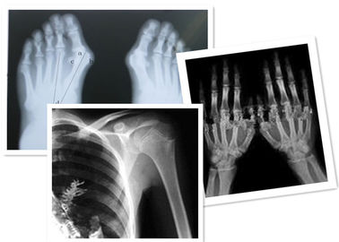 Good price Thermische Digitale Röntgenstraalfilm Fuji Medisch voor Radiografieonderzoek online