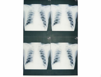 Witte het Document van de Basis Medische Röntgenstraal Film Vochtbestendig voor Sony/de Laserprinter van EPSON