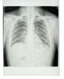 Douane 25cm * 30cm Witte het Document van de Basisröntgenstraal Medische Film met HUISDIERENmaterialen