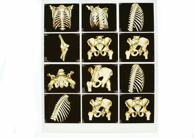 Wearable Witte Kenmerkende Weergave van de Basisröntgenstraal, de Medische Film van de Laser Blauwe Röntgenstraal