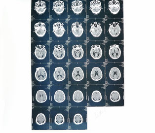 De medische Document Kenmerkende Weergave van de Laserprinterröntgenstraal voor het Ziekenhuis