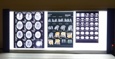 Good price 10in * 14in Digitale x-ray Droge Medische Weergavefilms voor Thermische Printers knd-F online