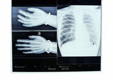 Good price De Hoge Resolutie Hittebestendige Weergave van de Konida Medische Droge Film online