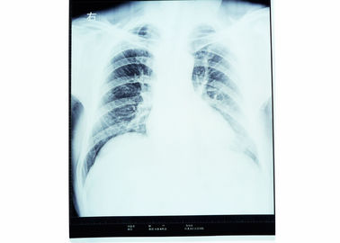 Good price De medische Droge Röntgenstraal van de Weergavefilm voor AGFA knd-a 5300/5302/5500 online