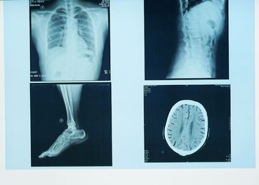 Duurzame Röntgenstraal Kenmerkende Weergave, 32cm x 43cm de Medische Document Film van de Laser Blauwe Röntgenstraal