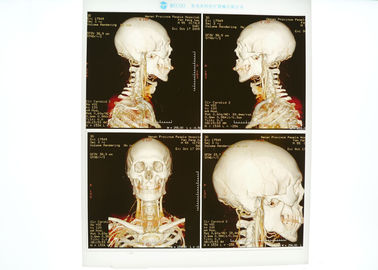 Good price Hoog - de Filmblauw van de dichtheids Medisch Röntgenstraal voor de Laserprinter van Konida online