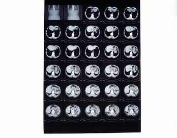 Good price Medische Röntgenstraalfilms, Droge Weergavefilm Compatibel met Thermische Printer voor CT/DR./MRI online