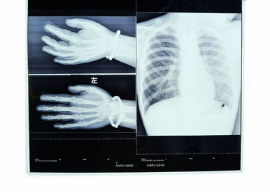 Lage Mist 14in * 17in Medische Film van de de Transparantie Thermische Printer van de Weergave Droge Röntgenstraal