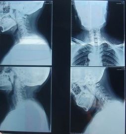 Good price Kras-Bestand Medische Document knd-k Droge Weergavefilm voor Radiografisch Onderzoek online